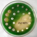 放线菌JXJ 0071对铜绿微囊藻的溶藻活性