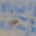 壬基酚对不同龄家兔结肠5-羟色胺细胞免疫组化影响的研究