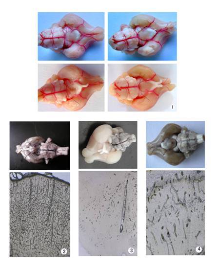 长爪沙鼠willis环变异筛选的实验研究