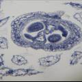 RFC3对拟南芥抗性生长和花器官发育的调控作用研究
