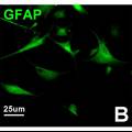 大鼠穹窿海马伞切割对海马伞内神经干细胞再生的影响