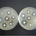 鸡源志贺菌和沙门菌的分离鉴定及药敏试验研究