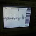 心音信号检测与分析系统
