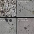 产绿原酸金银花内生菌的分离研究