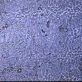 表皮干细胞构建组织工程角膜