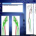 神经肌肉电生理信息诊断与管理系统（EMIS）
