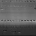 PCR-SSP法检测29种HLA-B27亚型